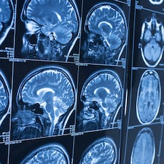 Estudio revela la edad hasta la que dura la adolescencia según el cerebro humano