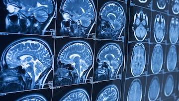 Nuevas evidencias muestran que la adolescencia no termina a los 20: el cerebro sigue en evolución aún por más años.