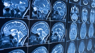 A esta edad termina de desarrollarse el cerebro humano: conoce todas sus etapas