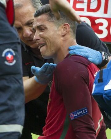 Cristiano Ronaldo se lesionó durante la final de la Eurocopa contra Francia. 