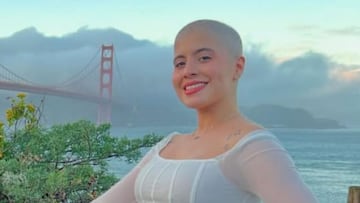 Muere la influencer Paola Caldera a los 30 años