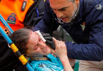 La linier del choque entre Betis y Athletic fue atendida por una brecha sufrida en un encontronazo con una cámara de televisión.