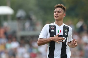 Allegri criticized the media for pressure put on Dybala