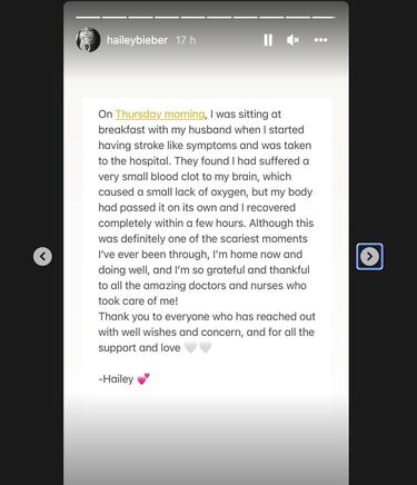 Hailey Bieber se recupera en casa de un ictus cerebral