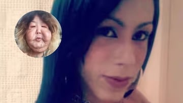 El impactante cambio físico de la influencer Juliana Oliveira tras sufrir una negligencia médica