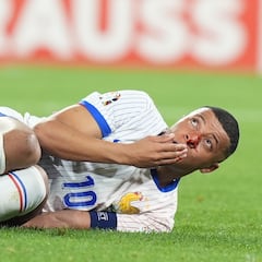 Las imágenes del impactante golpe en la nariz de Mbappé