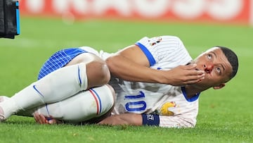 Kylian Mbappé tumbado en el césped tras recibir el impacto que le ocasiona una herida en el tabique nasal.