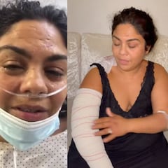 Saray Montoya, de los 'Gipsy Kings', es apuñalada por la familia de su marido