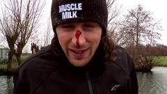 Uno de los riders de Nitro Circus mostrando el golpe en la nariz que aparece en el recopilatorio de fails de water can hurt, el agua puede doler 