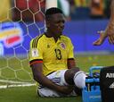 Yerry Mina sale lesionado en juego ante Botafogo