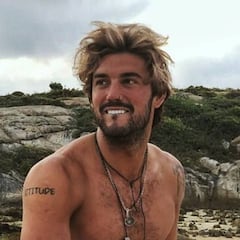 Así ha quedado el ojo de Logan tras su grave accidente