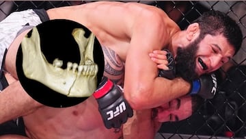 El destrozo de Chimaev a Whittaker: “Le van a tener que sujetar la boca con alambres”