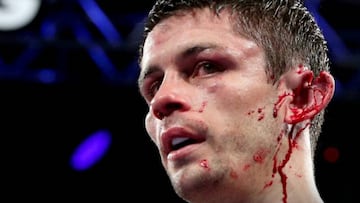Smith acabó con la oreja partida en el combate contra Vargas