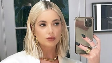 Ashley Benson muestra las secuelas físicas que sufre a causa de su problema de salud mental
