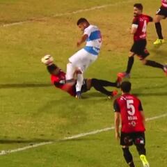 La grave lesión que sufrió un jugador de Antofagasta