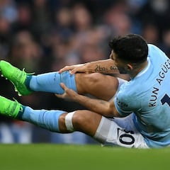 Surgery for Manchester City star Aguero