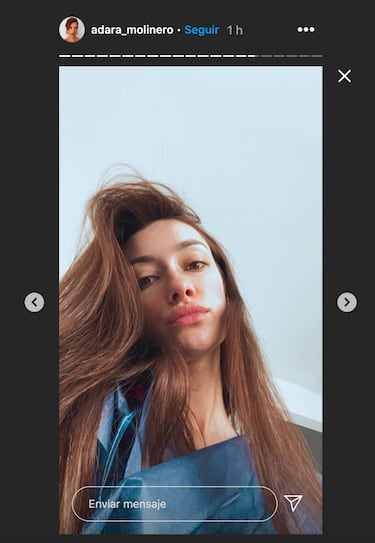 Adara Molinero se somete a una nueva operación de pecho