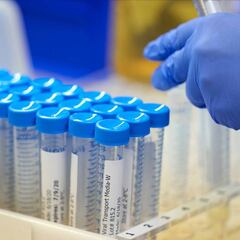 Rusia asegura tener una vacuna para mediados de agosto