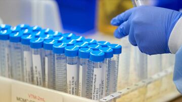 Rusia asegura tener una vacuna para mediados de agosto