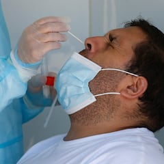 Viruela del mono en Chile: primer caso confirmado por el Minsal