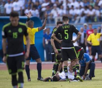 El mediocampista hondureño sufrió una impactante lesión, luego de que Javier Aquino le cayó encima de la pierna en una jugada sin intención en el duelo de Concacaf.