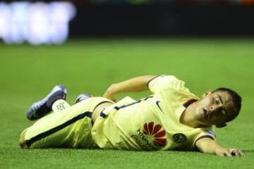 El lateral americanista sufrió lesión de ligamento colateral medial en la rodilla izquierda. Se espera que Aguilar este de vuelta en dos jornadas.