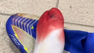 Lamine Yamal muestra el estado de su pie tras el encuentro frente a Las Palmas.