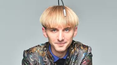 El primer ciborg de la historia lleva una antena implantada en la cabeza y revela de lo que es capaz: “Puedo conectar la antena a internet”