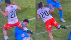 La terrible lesión que impacta en el fútbol chileno: hubo fractura