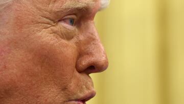 Trump has been tough on tariffs: here’s how they can be stopped.