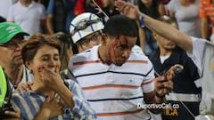 Hieren al hermano de Juan David Cabezas en la tribuna