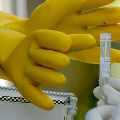 Test de saliva: la novedosa prueba para detectar la Covid-19 en 15 minutos