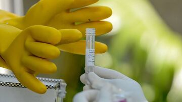 Test de saliva: la novedosa prueba para detectar la Covid-19 en 15 minutos