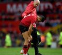 Alexis Sánchez preocupa al United con nueva lesión