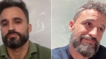 El cambio f¨ªsico de un enfermero tras un a?o de pandemia