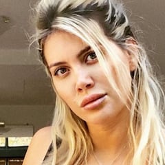 Wanda Nara niega haberse operado: "Me ven con un filtro y dicen que me operé"