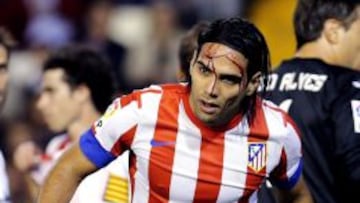 El delantero colombiano del Atlético de Madrid, Radamel Falcao, sangra por la frente tras su choque con el delantero Roberto Soldado, del Valencia CF, durante el partido, correspondiente a la décima jornada de la Liga de Primera División, que disputan los dos equipos, esta noche, en el estadio de Mestalla, en Valencia.