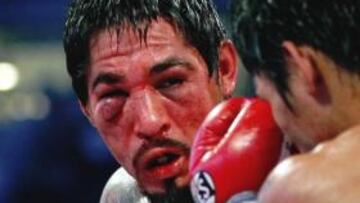 Tras someterse a una operación de cataratas, Antonio Margarito pasará un examen oftalmológico para obtener la licencia que le permita enfrentarse a Miguel Cotto.