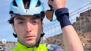 El ciclista italiano Gianmarco Garofoli muestra las heridas tras el atropello que sufrió este miércoles en Tenerife