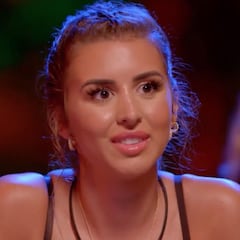 Marina García, de ‘La isla de las tentaciones’, muestra su rostro tras retirarse el ácido hialurónico