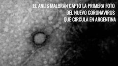 Coronavirus: toman la primera imagen del virus que circula en Argentina