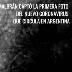 Coronavirus: toman la primera imagen del virus que circula en Argentina