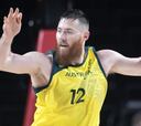 Baynes habla de la agonía: "Era como una combinación de quemaduras, fuego y cuchillos"