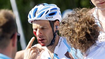 Jean-Christophe Peraud, con el rostro ensangrentado tras su ca&iacute;da.