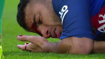 Piqué se fue con una sobrecarga y Rafinha sufrió un corte