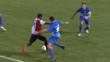 Lesión de Sinisterra