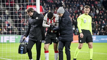 USMNT star suffers broken arm, World Cup in jeopardy