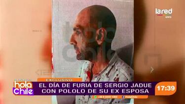 Las fotos de Sergio Jadue ensangrentado en Miami