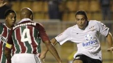 Ronaldo sobre su liposucción: "No sé ni si me operaron"