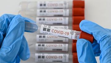 En Yucatán detectan dos nuevas cepas de Covid-19